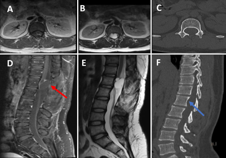 FIG. 1.