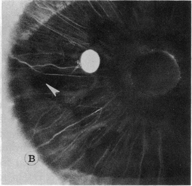 FIGURE 4 B