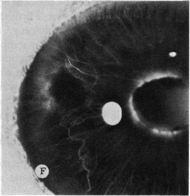 FIGURE 4 F