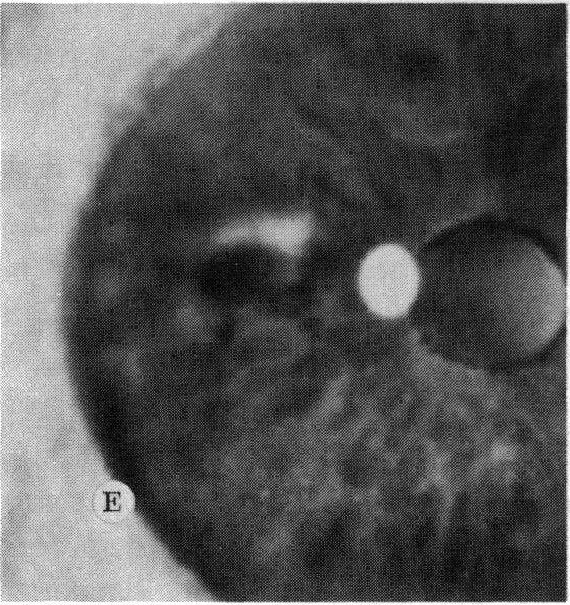 FIGURE 4 E