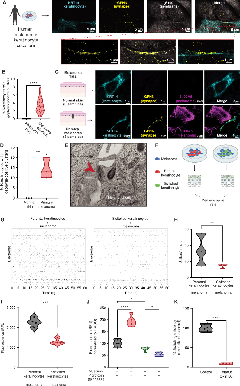 Figure 4. Melanoma cells form specialized cell–cell junctions with keratinocytes. A, Representative image of immunostaining for KRT14 (keratinocyte marker), S100 (membrane marker), and gephyrin (postsynapse GABAergic marker) in human melanoma/keratinocyte cocultures. Gephyrin-positive clusters are observed in keratinocytes only at sites of melanoma cell contact (zoomed in). Individual cells are pseudocolored as indicated. Left schematic created with BioRender.com. B, Quantification of gephyrin-positive clusters in melanoma/keratinocyte cocultures. Each datapoint represents a microscopic field quantified for the presence of keratinocyte gephyrin-positive clusters pooled from 4 biological replicates (n = 20). P values generated by unpaired t test; ****, P < 0.0001. C, Representative images of a patient malignant melanoma in situ and normal skin sample with immunostaining for KRT14 (keratinocyte marker), S100A6 (melanoma marker), and gephyrin (postsynapse GABAergic marker). Individual cells are pseudocolored as indicated. Left schematic created with BioRender.com. D, Violin plots showing percentage of keratinocytes with gephyrin-positive clusters in melanoma patient samples and normal skin. Data represent samples from n = 3 melanoma in situ patients, n = 3 normal skin; P values generated by unpaired t test; **, P < 0.01. E, Transmission electron microscopy of melanoma/keratinocyte cocultures with specialized cell–cell junction structures indicated with red arrowhead. A representative image is shown. F, Schematic representation for MEA experimental setup in human melanoma cocultures with parental or switched keratinocytes for 48 hours. Created with BioRender.com. G, Representative spike rastergrams of 1 minute of activity on MEA chip in 48-hour melanoma/keratinocyte cocultures. H, Quantification of MEA activity in 48-hour melanoma/keratinocyte cocultures calculated as spikes per minute (ratio: 1:5, melanoma:keratinocyte). Data represent 3 biological replicates per condition, with P values calculated using multiple unpaired t test using the Holm–Šídák method for multiple comparisons; **, P < 0.01. I, Calcium spike activity in cocultures of melanoma cells with switched or parental keratinocytes. RFU is relative fluorescence units measured using the calcium dye Rhod-4 (ratio: 1:5, melanoma:keratinocyte). Data represent 3 biological replicates per condition calculated using unpaired t test; ***, P < 0.001. J, Calcium spike activity in melanoma/keratinocyte cocultures upon the addition of a GABA-A agonist (muscimol), a GABA-A antagonist (picrotoxin), and a GABA-A allosteric modulator (SB205384; ratio: 1:5, melanoma:keratinocyte). RFU is a relative fluorescence unit measured using the calcium dye Cal-520. Data represent 6 biological replicates per condition calculated using one-way ANOVA with multiple comparisons; *, P < 0.05; ****, P < 0.0001. K, Percentage switching efficiency calculated as number of switched cells per well normalized to control upon melanoma-specific expression of tetanus toxin light chain (LC) in melanoma/keratinocyte cocultures for 48 hours pooled from 6 biological replicates (n = 12; ratio: 1:3, keratinocyte:melanoma). Error bars, SD; P values generated by unpaired t test; ****, P < 0.0001.