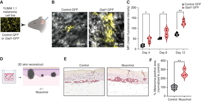 Figure 6. GABA-A receptor activation drives melanoma growth in mouse models and human 3D skin reconstructs. A, Schematic representation of the mouse ear transplant experiment in which YUMM 1.1 cells expressing control-GFP or Gad1-GFP are injected into mouse ears and imaged at 4, 8, and 12 days after injection. Created using BioRender.com. B, Representative images of mouse ears transplanted with control- or Gad1-GFP–expressing YUMM 1.1 mouse melanoma cells, 4 days after injection. C, Mean fluorescence intensity (MFI) in control- or Gad1-GFP–expressing mouse melanoma cells transplanted into mouse ears and imaged at 4, 8, and 12 days after injection in 4 biological replicates. Error bars, SD; P values generated by two-tailed unpaired t test; *, P < 0.05; **, P < 0.01. D, Schematic representation of 3D melanoma skin reconstruction experiments, in which the constructs were treated with the GABA-A receptor agonist muscimol. Created using BioRender.com. E, Representative images of IHC performed on 3D melanoma skin reconstructs treated with control media or muscimol-containing media, with melanoma cells stained with an anti-BRAFV600E antibody, after 24 days in coculture with keratinocytes and fibroblasts in 3D reconstruct media. F, Percentage melanoma-positive area (BRAFV600E-positive) in 3D skin reconstructs treated with control media or muscimol-containing media (100 μmol/L). Data are pooled from 3 biological replicates, normalized to control media. Error bars, SD; P values generated by two-tailed unpaired t test; **, P < 0.005.