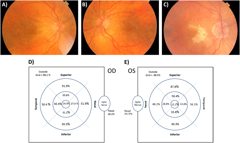 Fig. 1