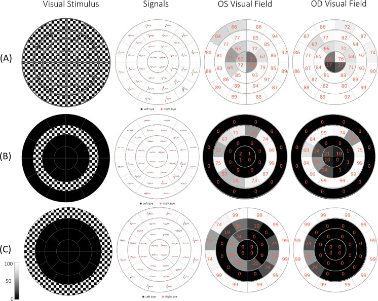 Fig. 11