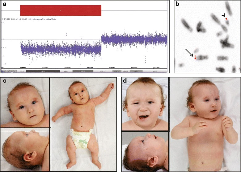 Fig. 1