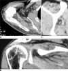 Fig. 1A–C