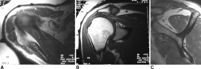 Fig. 2A–C