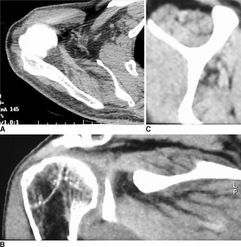 Fig. 1A–C