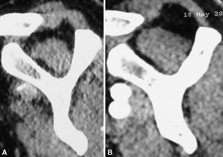 Fig. 3A–B