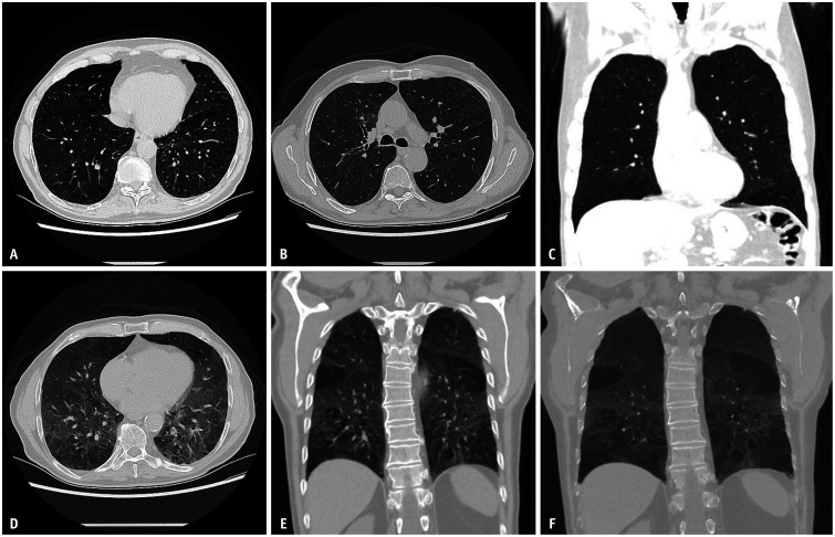 Fig. 13