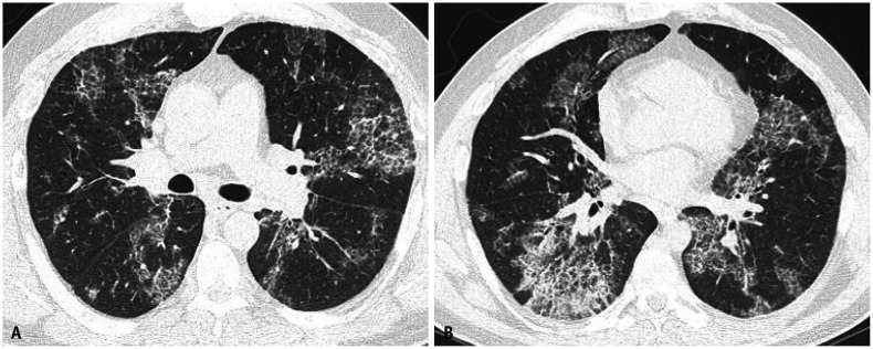 Fig. 11