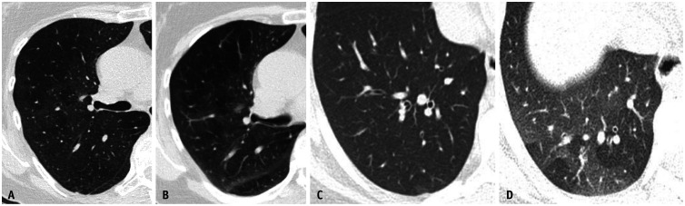 Fig. 16