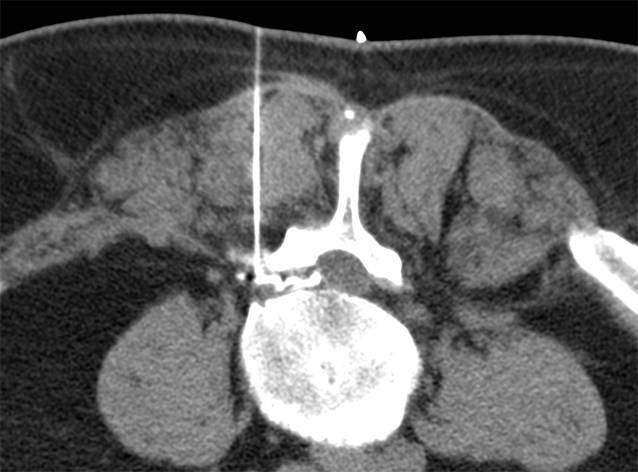 graphic file with name 117_2021_850_Fig1_HTML.jpg