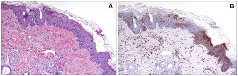 Fig 11