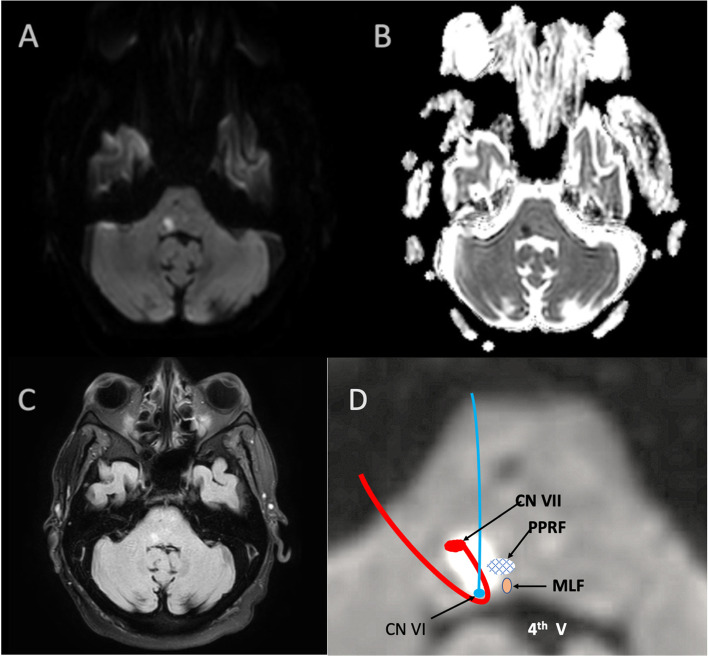 Fig. 2