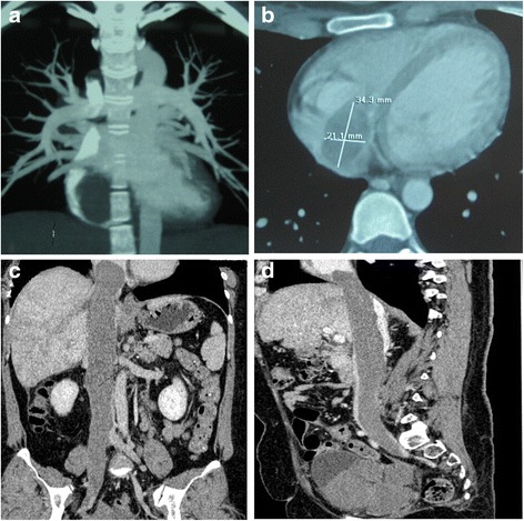 Fig 3