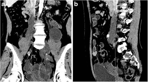 Fig 2