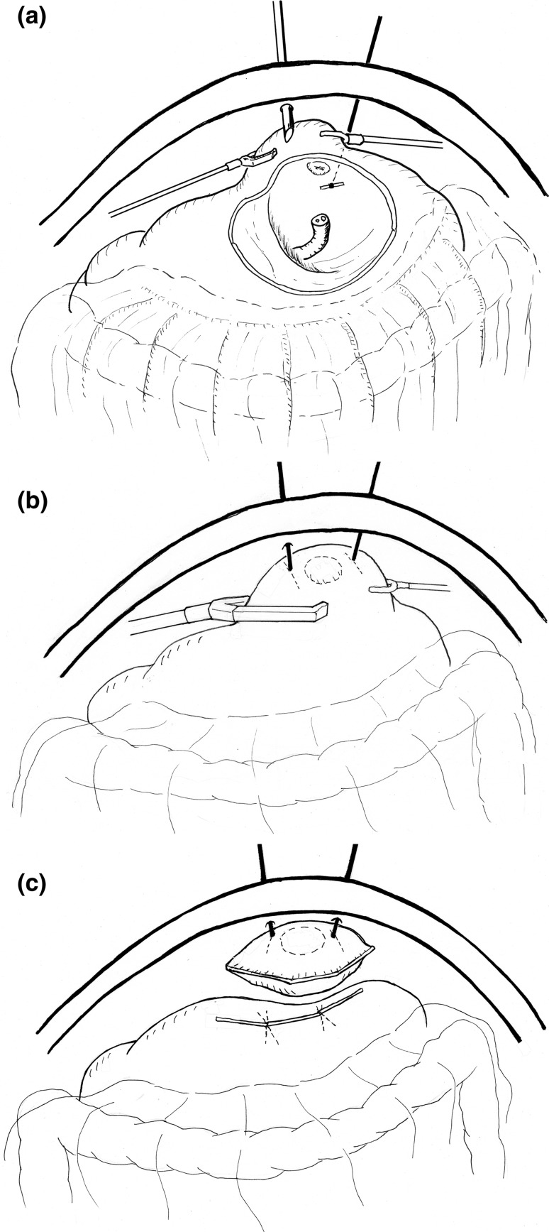 Fig. 1