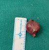 Fig. 4