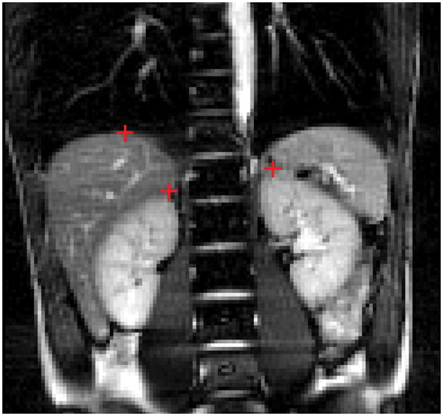 FIG. 1