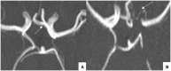 Figure 10.