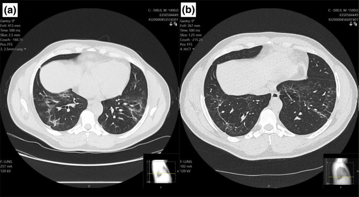 FIGURE 2