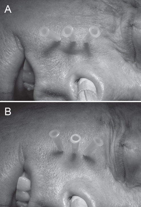 Figure 2)