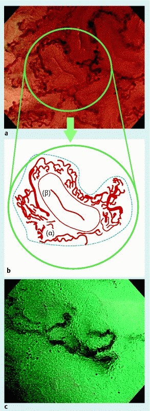 Fig. 2