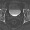 Figure 3b: