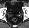 Figure 3a: