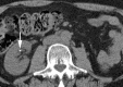 Figure 2a: