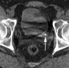 Figure 3c: