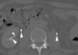 Figure 2c: