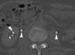 Figure 2d: