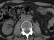 Figure 2e: