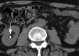 Figure 2b: