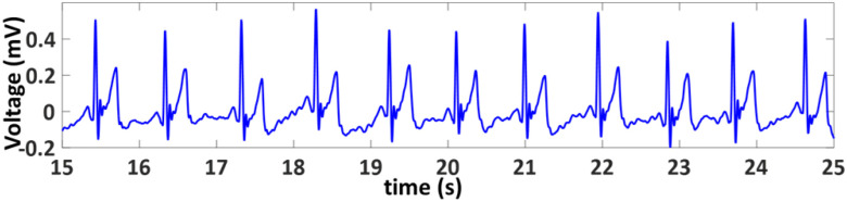 Fig. 13.