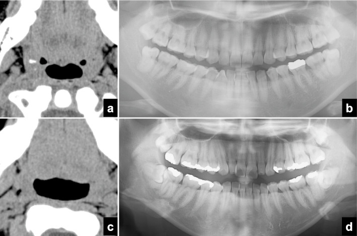 Fig. 4