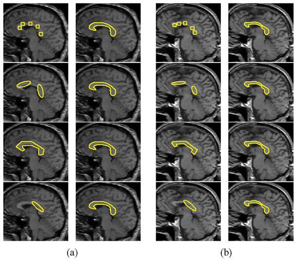 Fig. 13