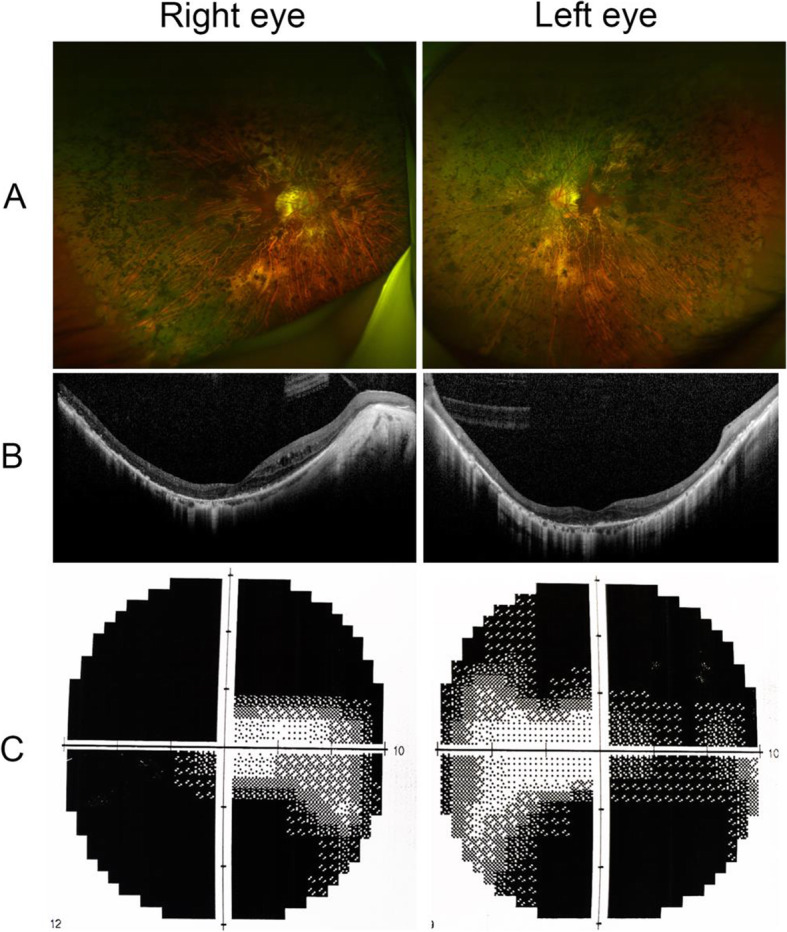 Fig. 3