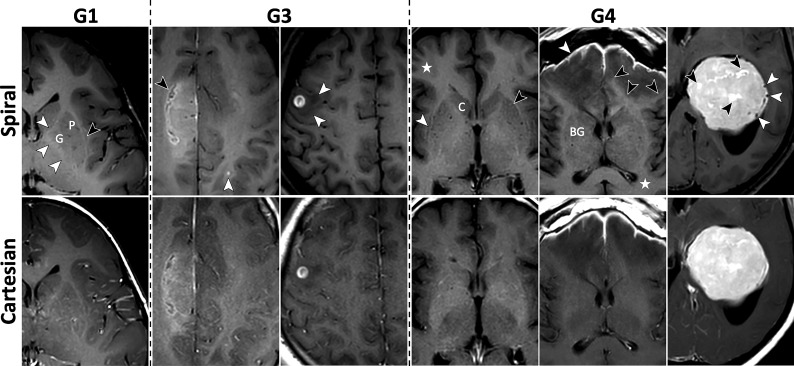 FIG 2.