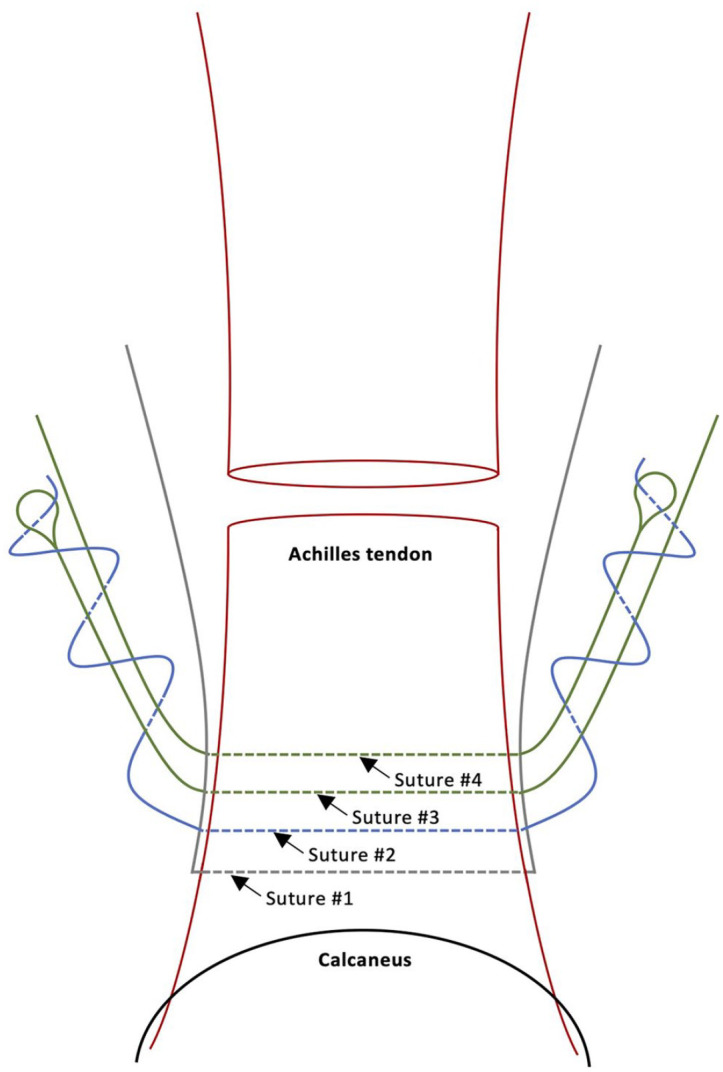 Figure 5.