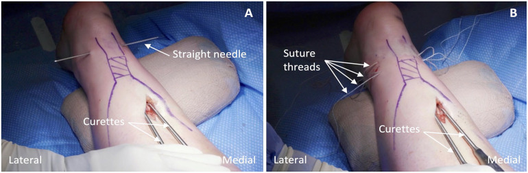 Figure 4.