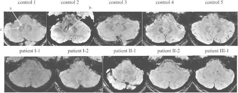 Fig. 4