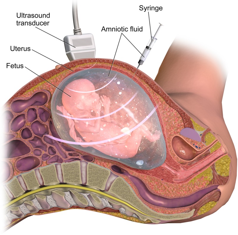 Figure 49