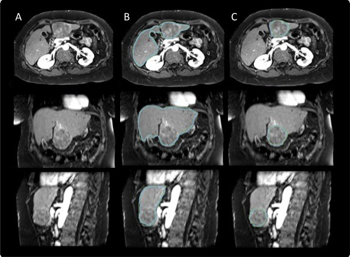 Fig. 2: