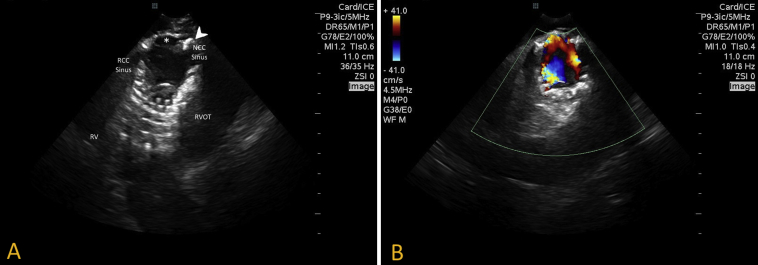 Figure 3