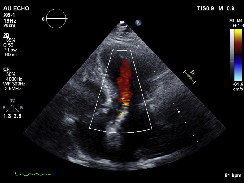 Figure 2