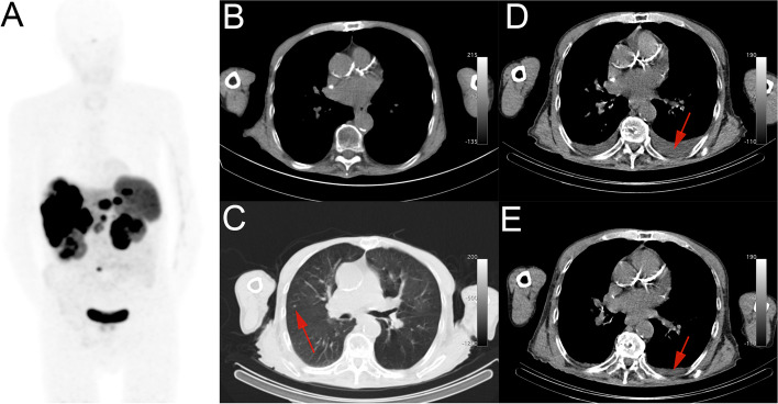 Fig. 3