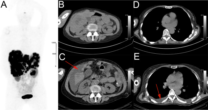 Fig. 2